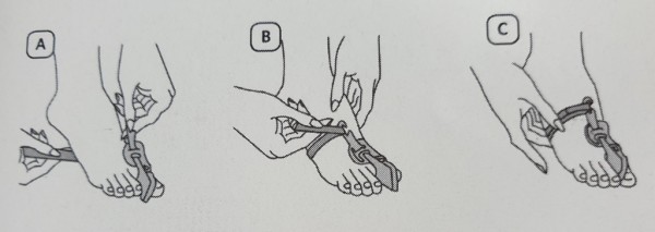 Stock Fachmann Hallux valgus Nachtschiene Exklusive Angebote